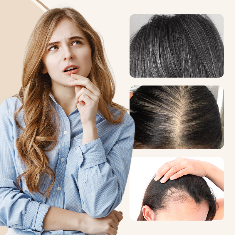 ⏰LAST DAY 58% OFF💝Natural Clip-on Partial Bangs Hair Piece