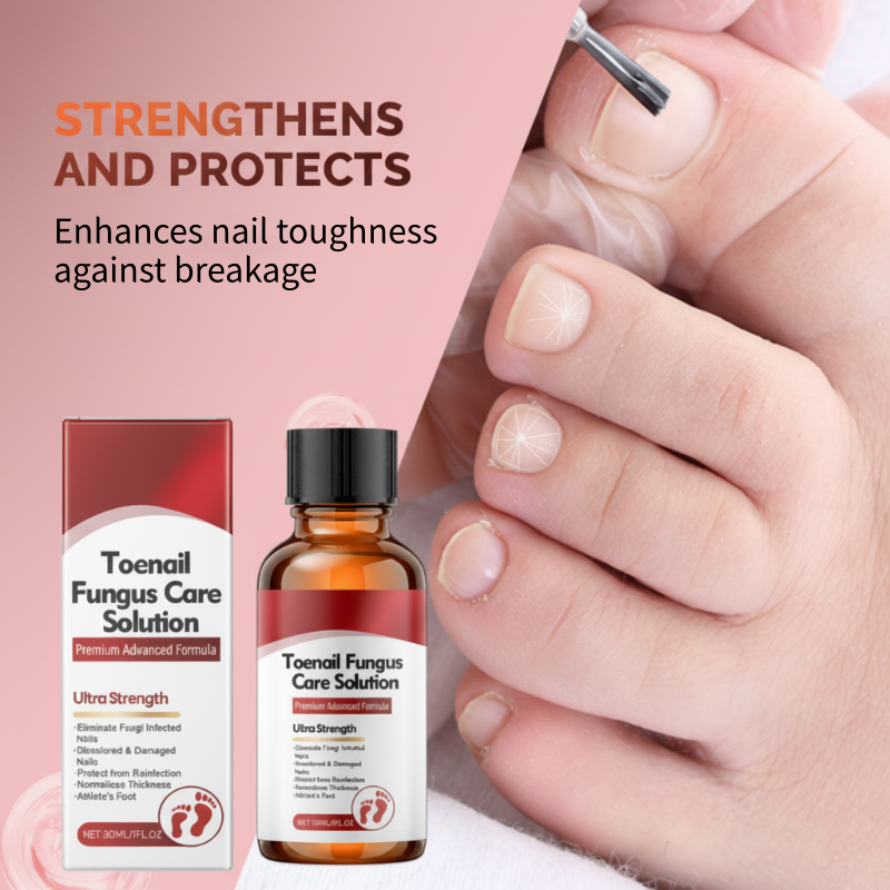 🎄Christmas Sale🎁Nail Repair Essence for Damaged Nails